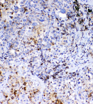 CD36 Rabbit Polyclonal Antibody