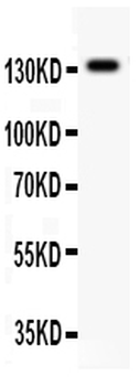 NMDAR2C/GRIN2C Rabbit Polyclonal Antibody