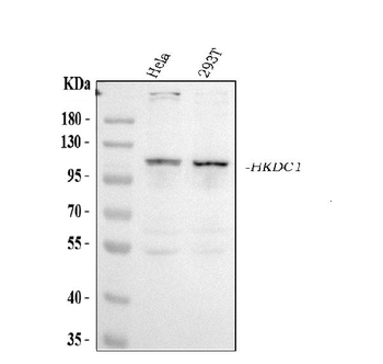 HKDC1 Rabbit Polyclonal Antibody