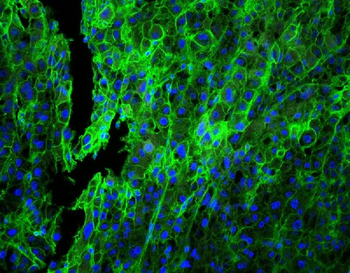 HLA-C/HLA Rabbit Polyclonal Antibody