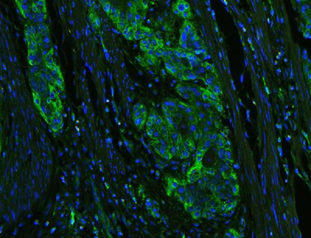 HLA-C/HLA Rabbit Polyclonal Antibody