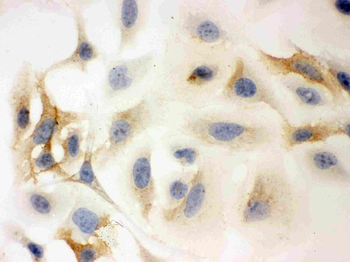 HLA-C/HLA Rabbit Polyclonal Antibody