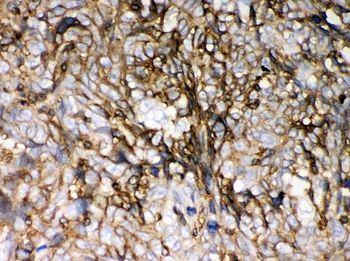 HLA-C/HLA Rabbit Polyclonal Antibody