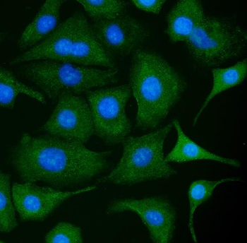 PKM2 Rabbit Polyclonal Antibody