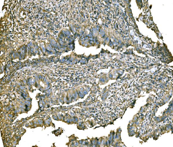 PKM2 Rabbit Polyclonal Antibody