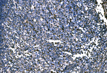 PKM2 Rabbit Polyclonal Antibody