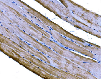 PKM2 Rabbit Polyclonal Antibody
