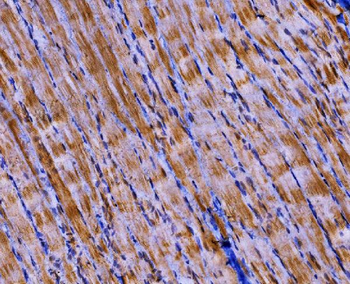 PKM2 Rabbit Polyclonal Antibody