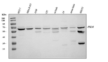 PKM2 Rabbit Polyclonal Antibody