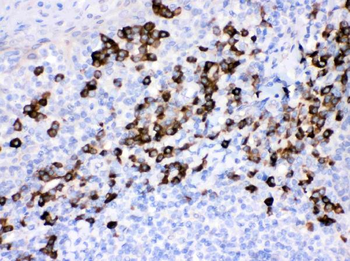 Peroxiredoxin 4/PRDX4 Rabbit Polyclonal Antibody