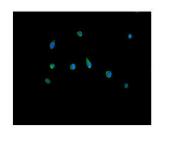 Peroxiredoxin 5/PRDX5 Rabbit Polyclonal Antibody