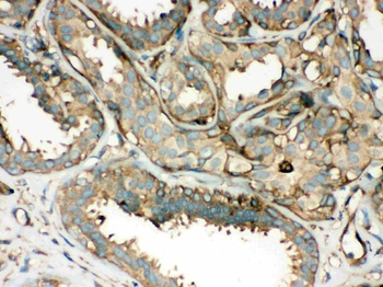 ROCK2 Rabbit Polyclonal Antibody