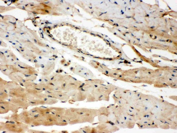 ROCK2 Rabbit Polyclonal Antibody
