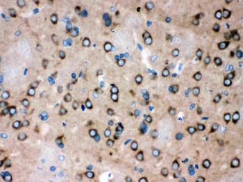 ROCK2 Rabbit Polyclonal Antibody