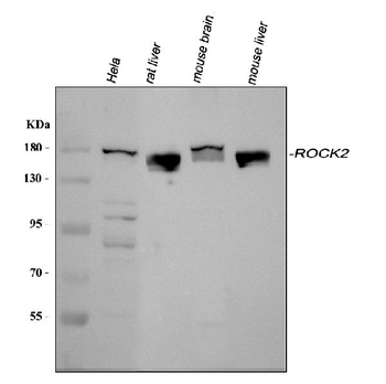 ROCK2 Rabbit Polyclonal Antibody