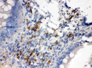 Syndecan 4/SDC4 Rabbit Polyclonal Antibody