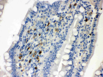 Syndecan 4/SDC4 Rabbit Polyclonal Antibody