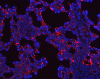 SFTPA1/2 Rabbit Polyclonal Antibody