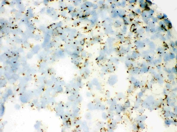 SFTPA1/2 Rabbit Polyclonal Antibody