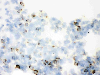 SFTPA1/2 Rabbit Polyclonal Antibody