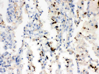 SFTPA1/2 Rabbit Polyclonal Antibody