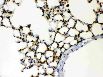 SFTPA1/2 Rabbit Polyclonal Antibody