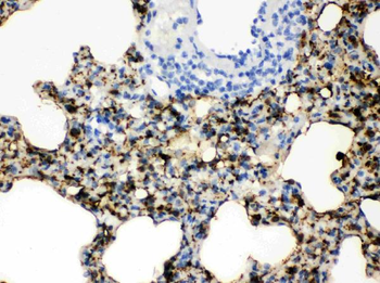 SFTPA1/2 Rabbit Polyclonal Antibody