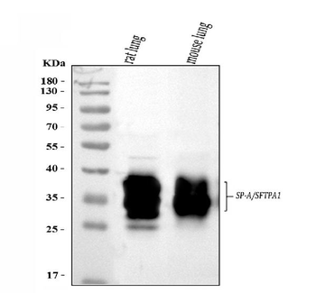 SFTPA1/2 Rabbit Polyclonal Antibody