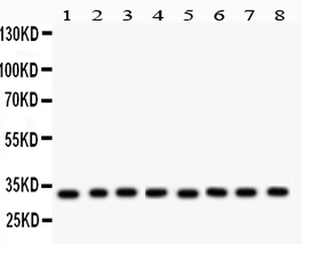 SMN1/2 Rabbit Polyclonal Antibody