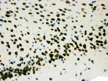 SMN1/2 Rabbit Polyclonal Antibody