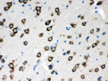 SMN1/2 Rabbit Polyclonal Antibody