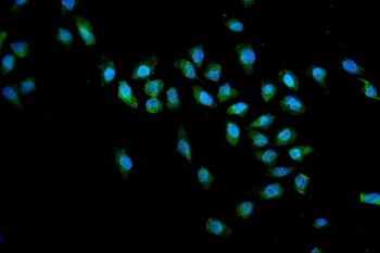 SMN1/2 Rabbit Polyclonal Antibody