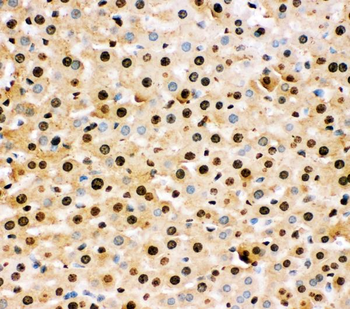 Superoxide Dismutase 1/SOD1 Rabbit Polyclonal Antibody