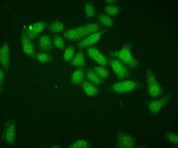 Superoxide Dismutase 1/SOD1 Rabbit Polyclonal Antibody