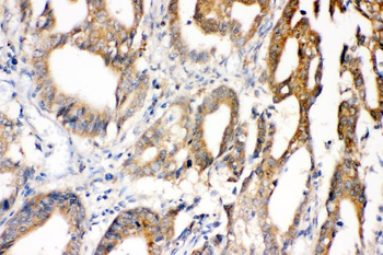 Superoxide Dismutase 1/SOD1 Rabbit Polyclonal Antibody