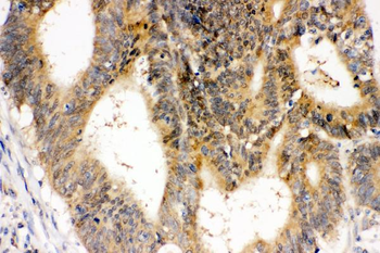 Superoxide Dismutase 1/SOD1 Rabbit Polyclonal Antibody