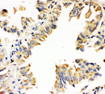 Superoxide Dismutase 1/SOD1 Rabbit Polyclonal Antibody