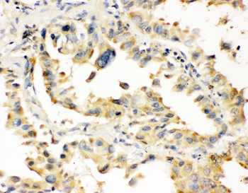 Superoxide Dismutase 1/SOD1 Rabbit Polyclonal Antibody