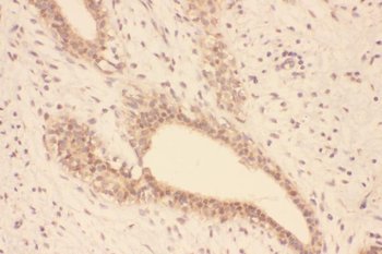Superoxide Dismutase 1/SOD1 Rabbit Polyclonal Antibody