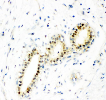 Superoxide Dismutase 1/SOD1 Rabbit Polyclonal Antibody
