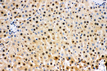 Superoxide Dismutase 1/SOD1 Rabbit Polyclonal Antibody