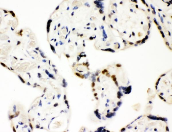 SF2/SRSF1 Rabbit Polyclonal Antibody