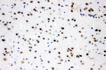 SF2/SRSF1 Rabbit Polyclonal Antibody