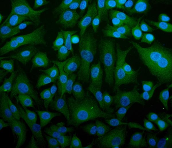 STIM1 Rabbit Polyclonal Antibody