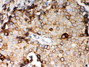 STIM1 Rabbit Polyclonal Antibody