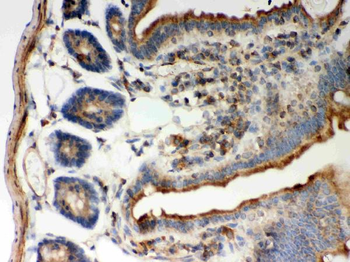 STIM1 Rabbit Polyclonal Antibody