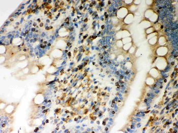 STIM1 Rabbit Polyclonal Antibody