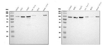 STIM1 Rabbit Polyclonal Antibody