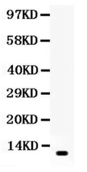 Resistin/RETN Rabbit Polyclonal Antibody