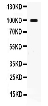 RANK/TNFRSF11A Rabbit Polyclonal Antibody